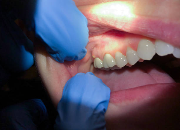 Professional Emergency Dental Service in UT